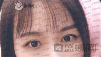 武汉中爱铭医,祁向峰,,案例,价格,