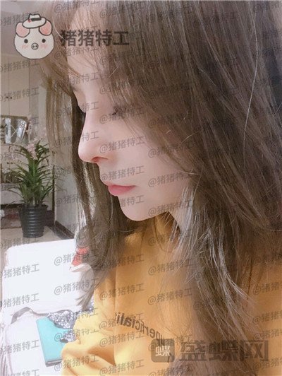 重庆铂生,杜亚旭,隆鼻,案例,价格,