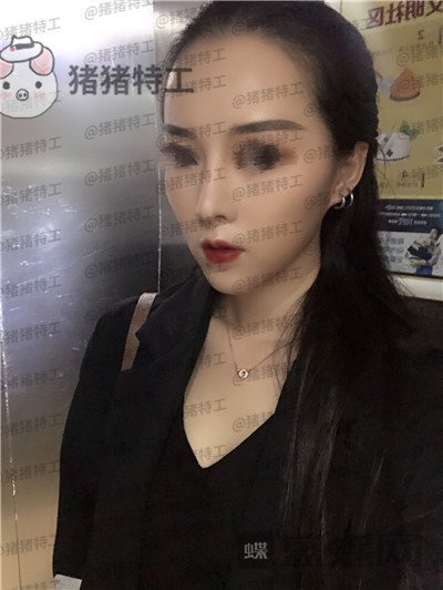 成都西区医院,车红昌,,案例,价格,