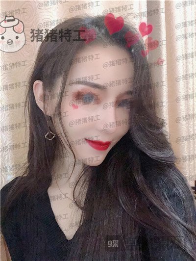 成都西区医院,车红昌,,案例,价格,