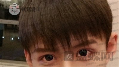 北京美莱,余辉,,案例,价格,