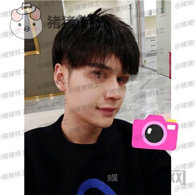 北京美莱,黄罡,隆鼻,驼峰鼻修正,案例,价格,