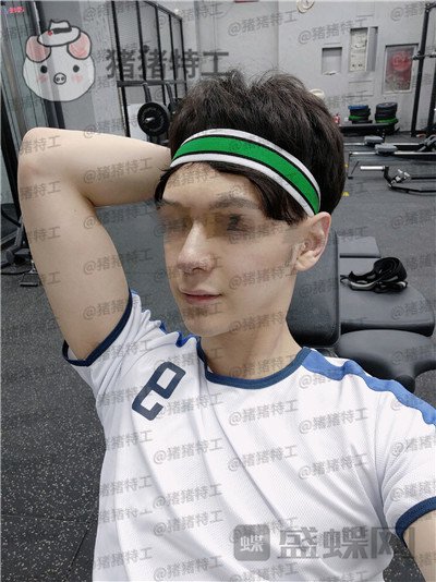 北京美莱,黄罡,隆鼻,驼峰鼻修正,案例,价格,