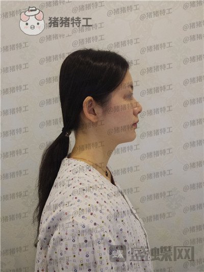 南京美贝尔,黄名斗,,案例,价格,