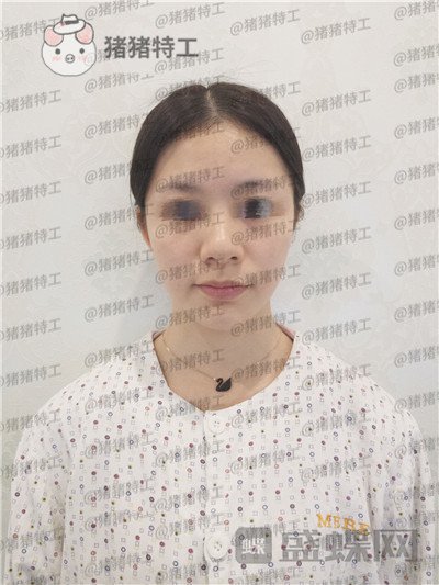 南京美贝尔,黄名斗,,案例,价格,