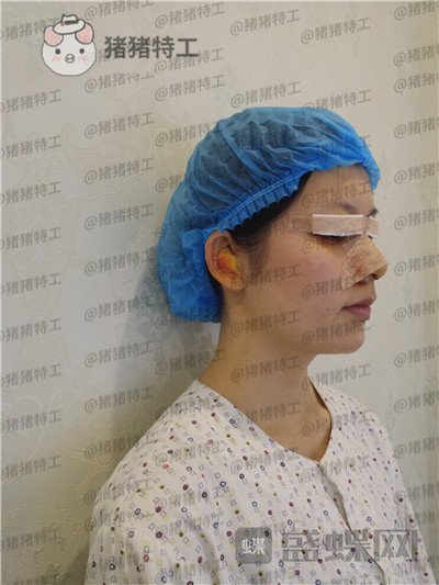 南京美贝尔,黄名斗,,案例,价格,