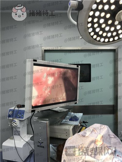 深圳仁安雅,苗春来,丰臀,案例,价格,