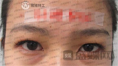 成都素美,杨迪,,案例,价格,