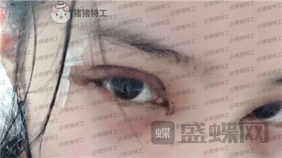 成都素美,杨迪,,案例,价格,