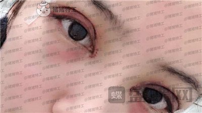 成都素美,杨迪,,案例,价格,