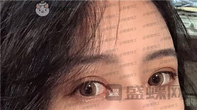成都素美,杨迪,,案例,价格,