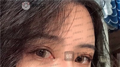 成都素美,杨迪,,案例,价格,