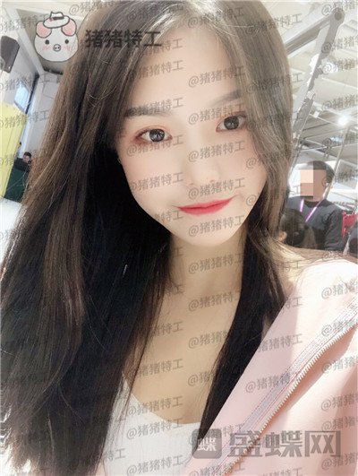 兰州亚韩,李军梅,隆鼻,案例,价格,