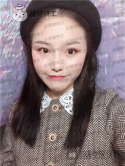 兰州亚韩,李军梅,隆鼻,案例,价格,