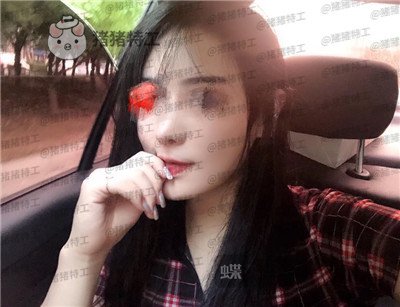 北京壹加壹,张绿峰,面部填充,案例,价格,