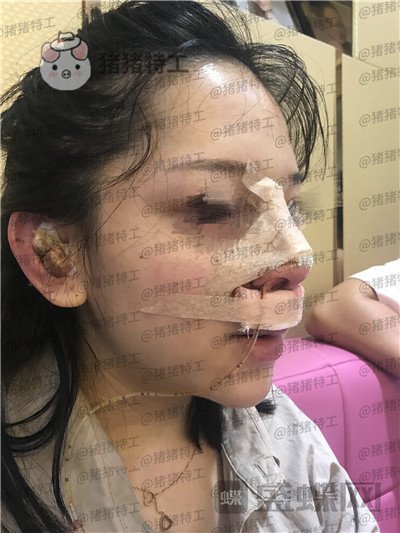 厦门福华,金贵香,,案例,价格,