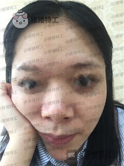 厦门福华,金贵香,,案例,价格,