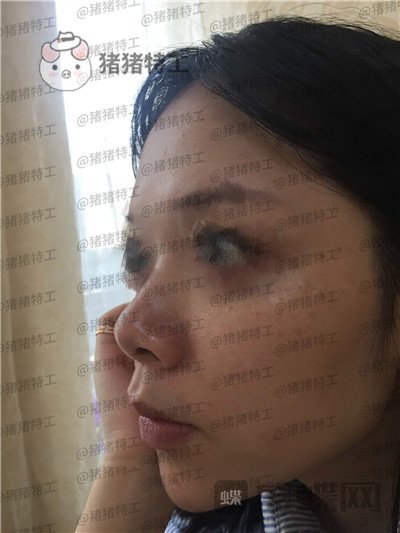 厦门福华,金贵香,,案例,价格,