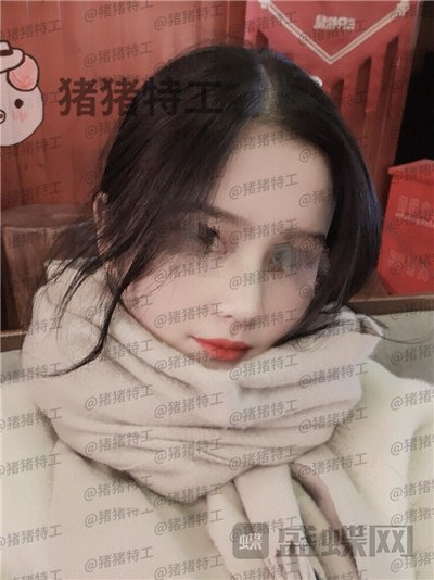 武汉同济,曾宁,隆鼻,案例,价格,