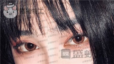 杭州美莱,韩超,双眼皮,案例,价格,