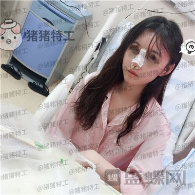 苏州美莱,吴蓉,,案例,价格,