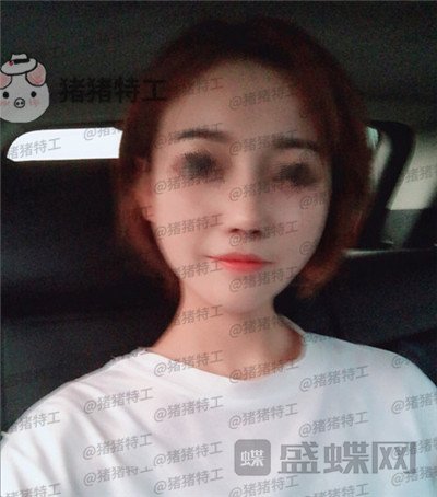 苏州美莱,吴蓉,,案例,价格,