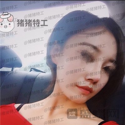 苏州美莱,吴蓉,,案例,价格,