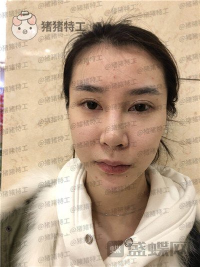 杭州维多利亚,刘中策,,案例,价格,