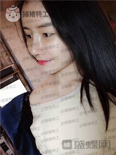 成都格莱丽,王伟,隆鼻,案例,价格,