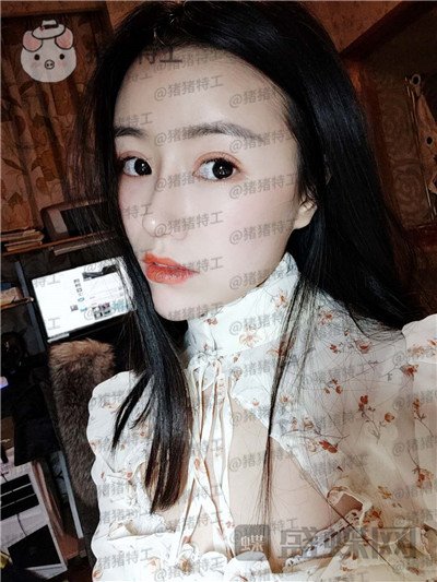 成都格莱丽,王伟,隆鼻,案例,价格,