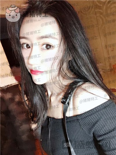 成都格莱丽,王伟,隆鼻,案例,价格,
