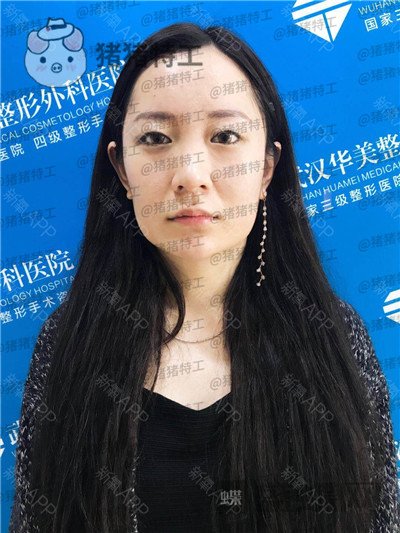 武汉华美,马行,,案例,价格,