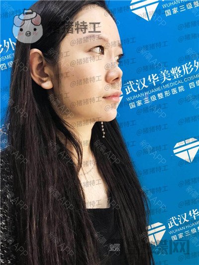 武汉华美,马行,,案例,价格,