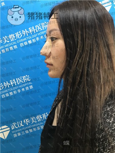 武汉华美,马行,,案例,价格,