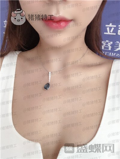 长沙美沃,孔伟立,厚唇改薄,案例,价格,