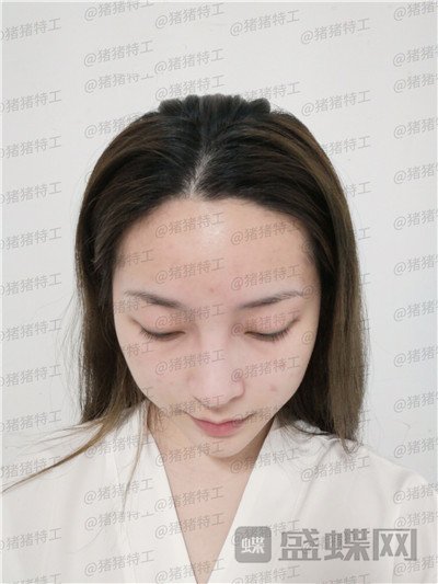南宁连美,刘泳铖,,案例,价格,