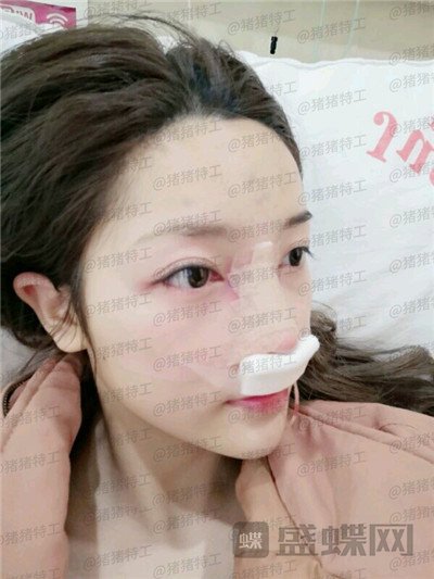 南宁连美,刘泳铖,,案例,价格,