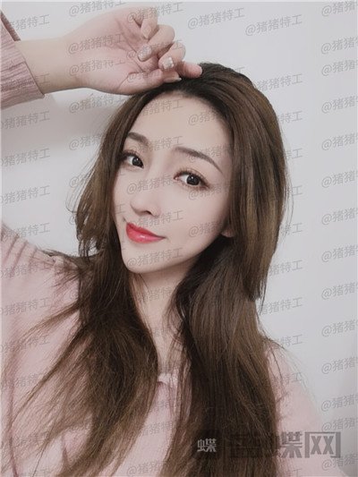 南宁连美,刘泳铖,,案例,价格,