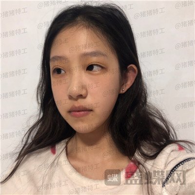 杭州美莱,韩超,,案例,价格,