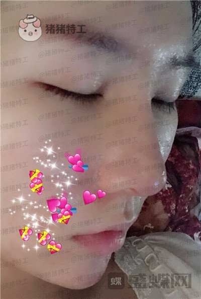 重庆中民整形科,孙刚,,案例,价格,