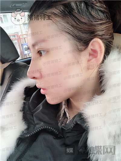重庆中民整形科,孙刚,,案例,价格,