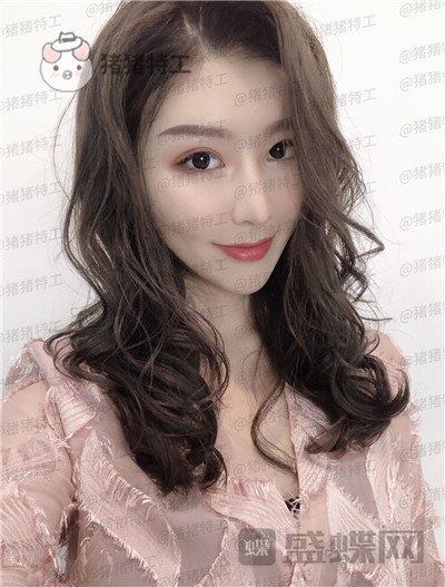 重庆中民整形科,孙刚,,案例,价格,