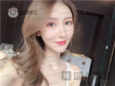 重庆中民整形科,孙刚,,案例,价格,