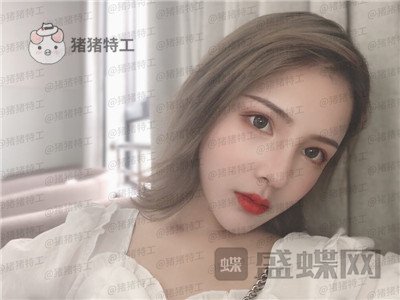 上海伯思立,李茂群,隆鼻,案例,价格,分享,