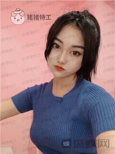 宁波珈禾,费安军,双眼皮,案例,价格,