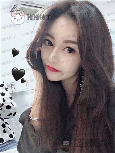 宁波珈禾,费安军,双眼皮,案例,价格,