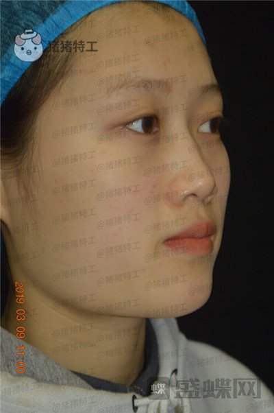 长沙晶肤，朱苗，，案例，价格，