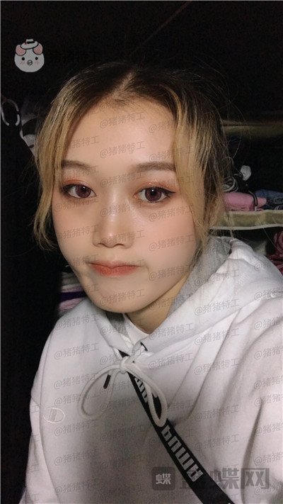 长沙晶肤，朱苗，，案例，价格，