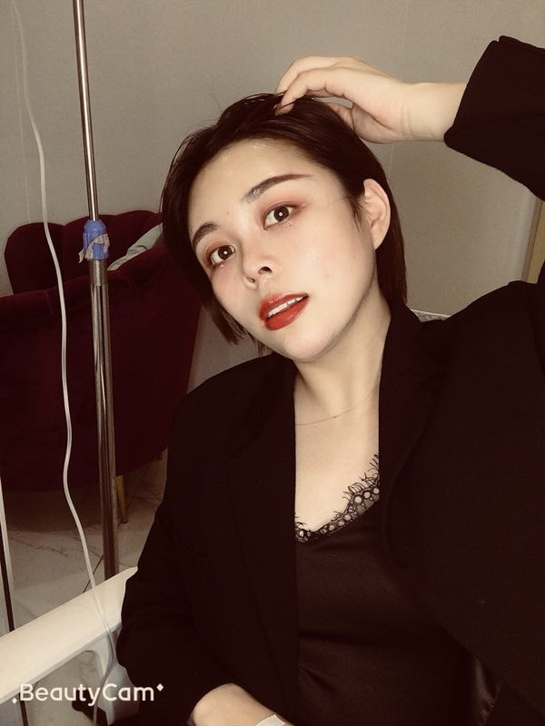 杭州港丽曹飞超自体脂肪填充怎么样？价格案例