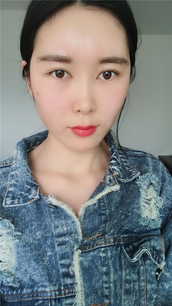 武汉华美付国友脂肪填充怎么样?价格案例